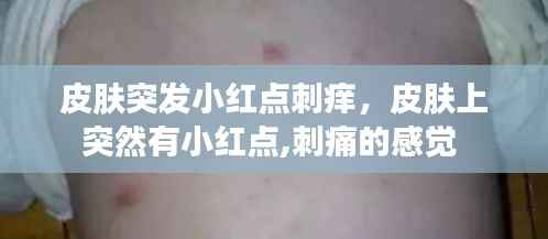 皮肤突发小红点刺痒,皮肤上突然有小红点,刺痛的感觉