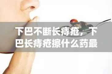 下巴不断长痔疮,下巴长痔疮擦什么药最有效