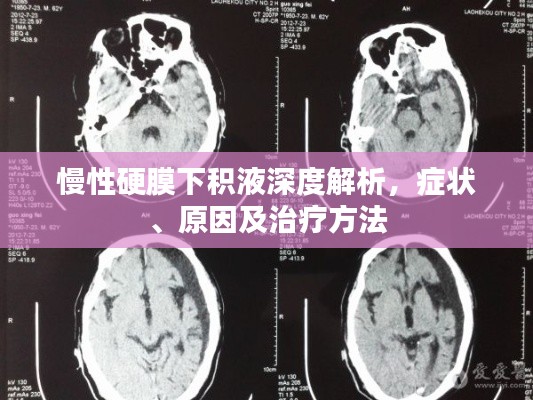 慢性硬膜下积液深度解析,症状、原因及治疗方法