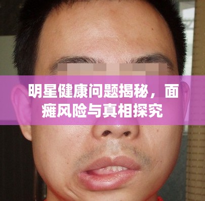 明星健康问题揭秘,面瘫风险与真相探究